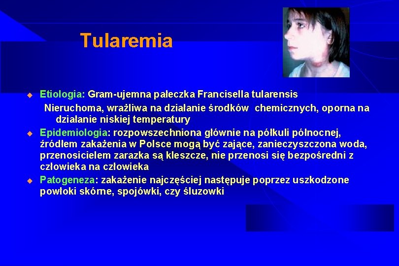 Tularemia u u u Etiologia: Gram-ujemna pałeczka Francisella tularensis Nieruchoma, wrażliwa na działanie środków