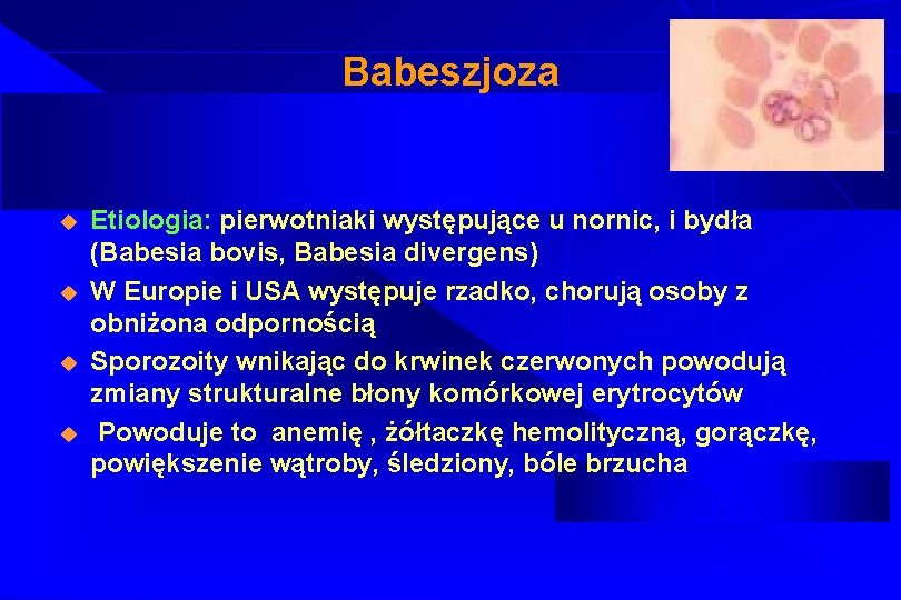 Babeszjoza u u Etiologia: pierwotniaki występujące u nornic, i bydła (Babesia bovis, Babesia divergens)