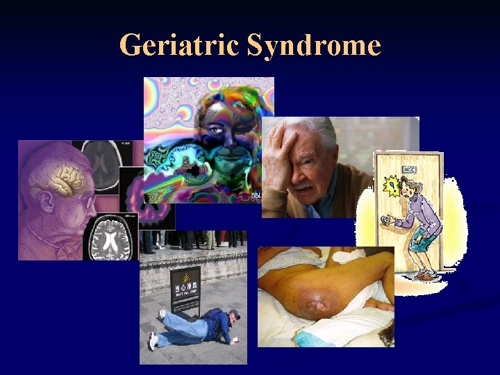 Geriatric Syndrome 