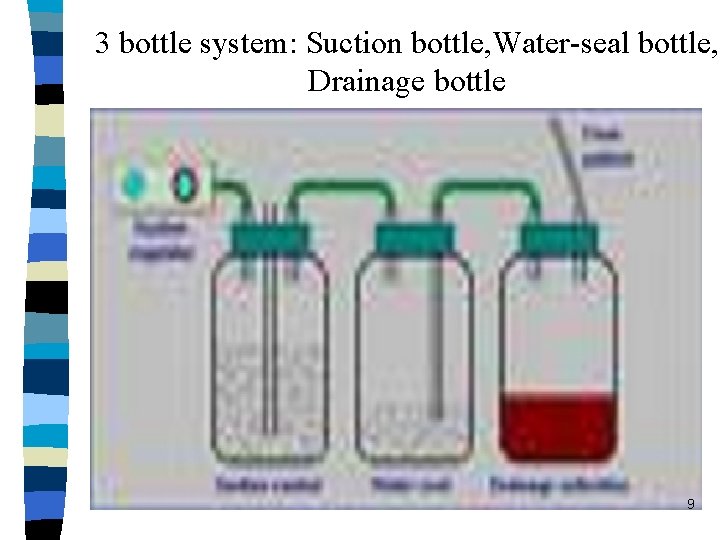 3 bottle system: Suction bottle, Water-seal bottle, Drainage bottle 9 