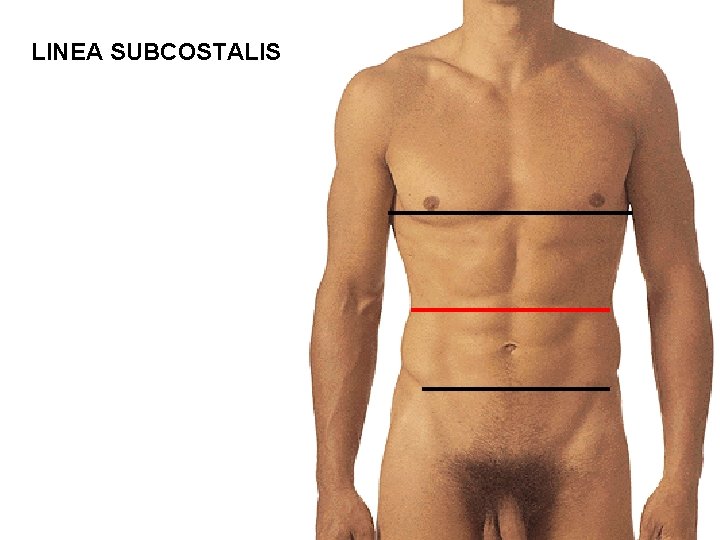 LINEA SUBCOSTALIS 