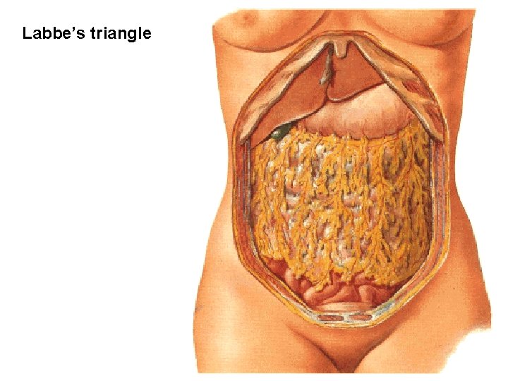 Labbe’s triangle 