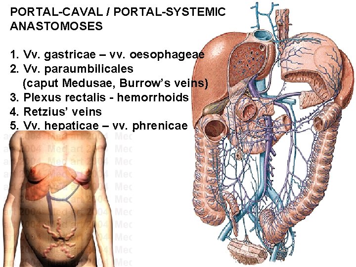 PORTAL-CAVAL / PORTAL-SYSTEMIC ANASTOMOSES 1. Vv. gastricae – vv. oesophageae 2. Vv. paraumbilicales (caput