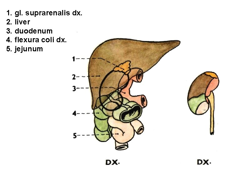 1. gl. suprarenalis dx. 2. liver 3. duodenum 4. flexura coli dx. 5. jejunum