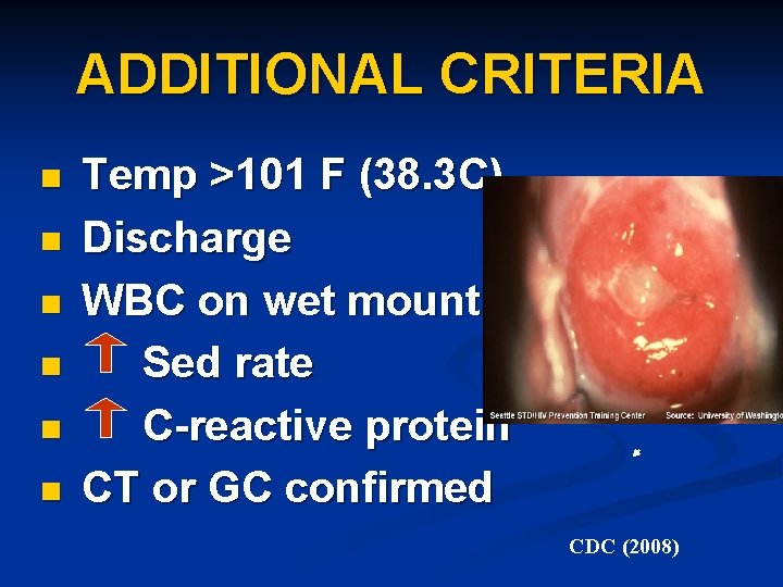 ADDITIONAL CRITERIA n n n Temp >101 F (38. 3 C) Discharge WBC on