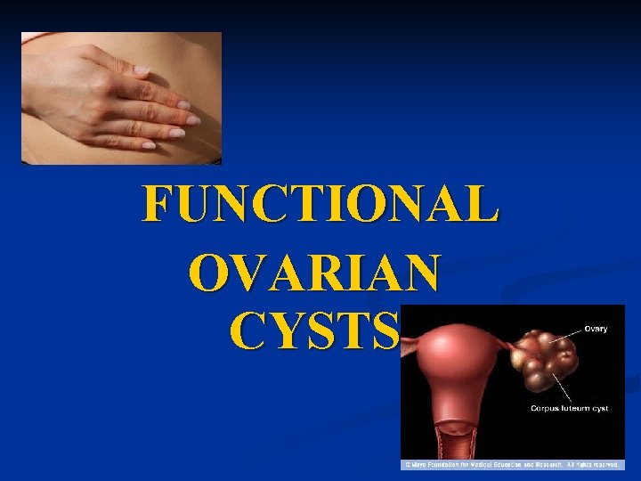 FUNCTIONAL OVARIAN CYSTS 