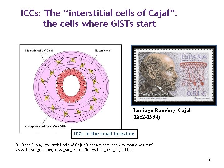 ICCs: The “interstitial cells of Cajal”: the cells where GISTs start Santiago Ramón y
