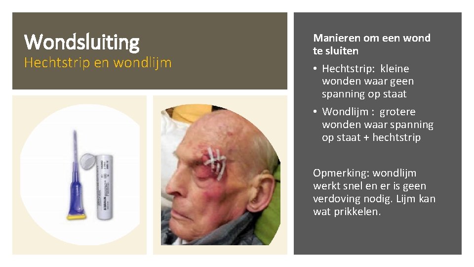Wondsluiting Hechtstrip en wondlijm Manieren om een wond te sluiten • Hechtstrip: kleine wonden