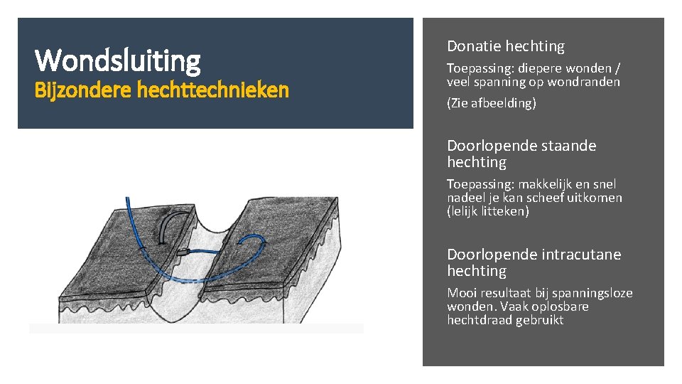 Wondsluiting Bijzondere hechttechnieken Donatie hechting Toepassing: diepere wonden / veel spanning op wondranden (Zie