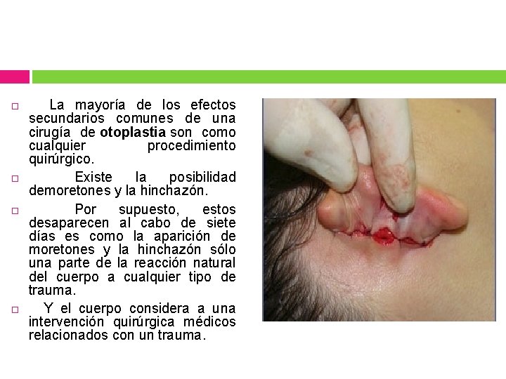  La mayoría de los efectos secundarios comunes de una cirugía de otoplastia son