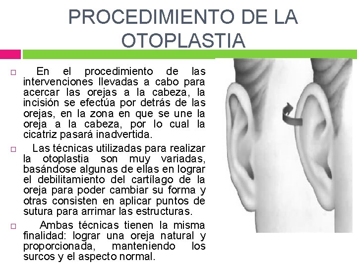 PROCEDIMIENTO DE LA OTOPLASTIA En el procedimiento de las intervenciones llevadas a cabo para