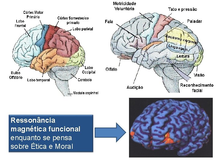Ressonância magnética funcional enquanto se pensa sobre Ética e Moral 
