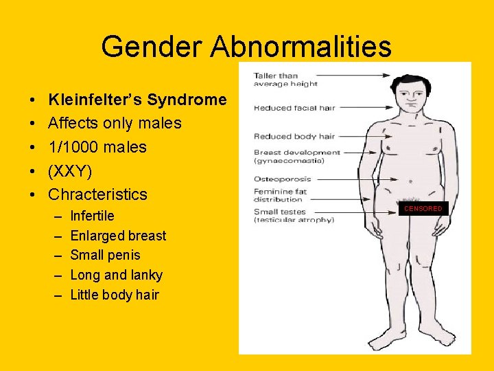 Gender Abnormalities • • • Kleinfelter’s Syndrome Affects only males 1/1000 males (XXY) Chracteristics Gender Abnormalities • • • Kleinfelter’s Syndrome Affects only males 1/1000 males (XXY) Chracteristics