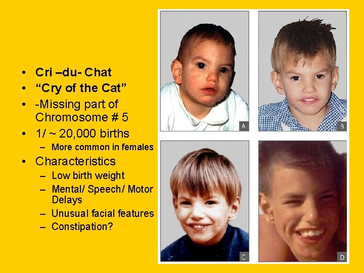 • Cri –du- Chat • “Cry of the Cat” • -Missing part of • Cri –du- Chat • “Cry of the Cat” • -Missing part of