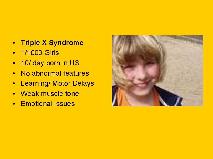 • • Triple X Syndrome 1/1000 Girls 10/ day born in US No • • Triple X Syndrome 1/1000 Girls 10/ day born in US No