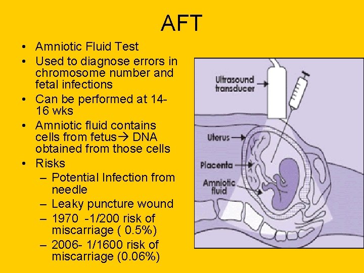 AFT • Amniotic Fluid Test • Used to diagnose errors in chromosome number and AFT • Amniotic Fluid Test • Used to diagnose errors in chromosome number and