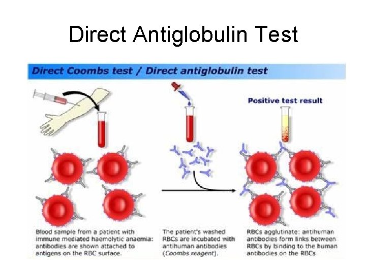 Direct Antiglobulin Test 