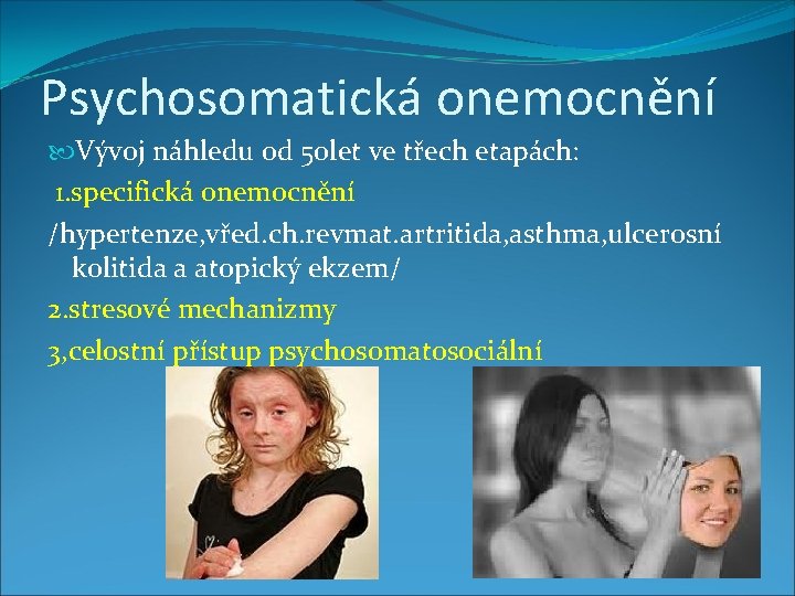 Psychosomatická onemocnění Vývoj náhledu od 50 let ve třech etapách: 1. specifická onemocnění /hypertenze,