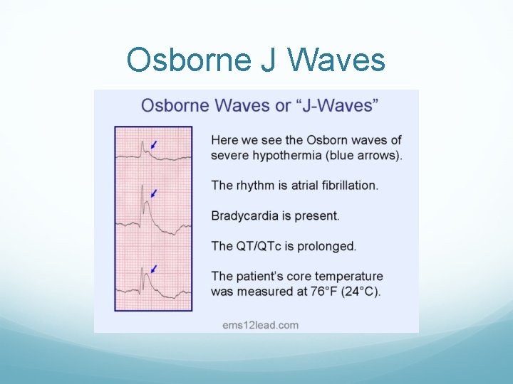 Osborne J Waves 