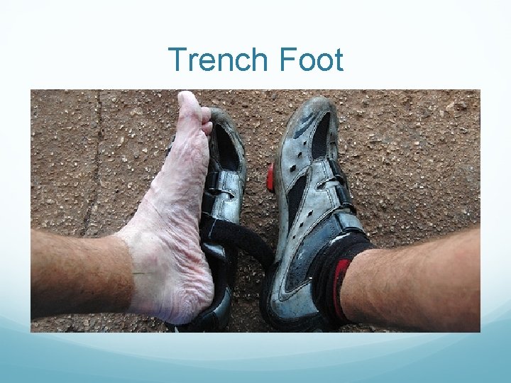 Trench Foot 