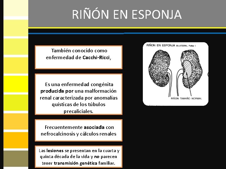 RIÑÓN EN ESPONJA También conocido como enfermedad de Cacchi-Ricci, Es una enfermedad congénita producida