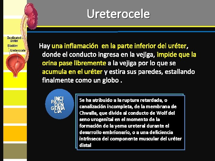 Ureterocele Hay una inflamación en la parte inferior del uréter, donde el conducto ingresa