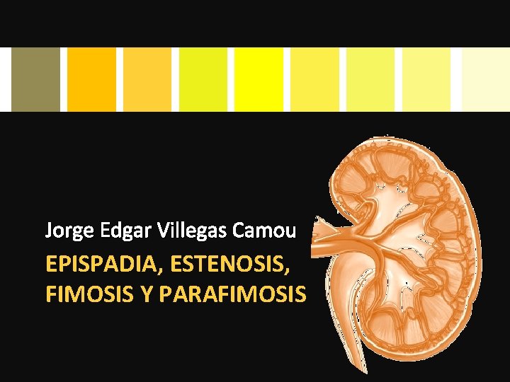 Jorge Edgar Villegas Camou EPISPADIA, ESTENOSIS, FIMOSIS Y PARAFIMOSIS 