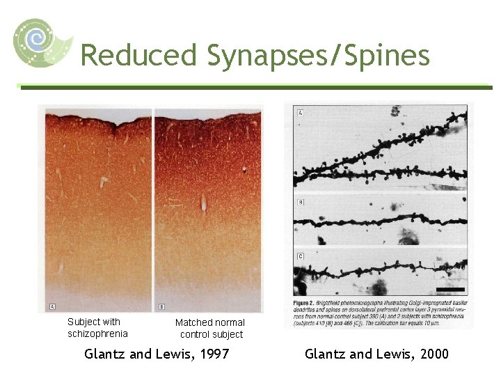 Reduced Synapses/Spines Subject with schizophrenia Matched normal control subject Glantz and Lewis, 1997 Glantz