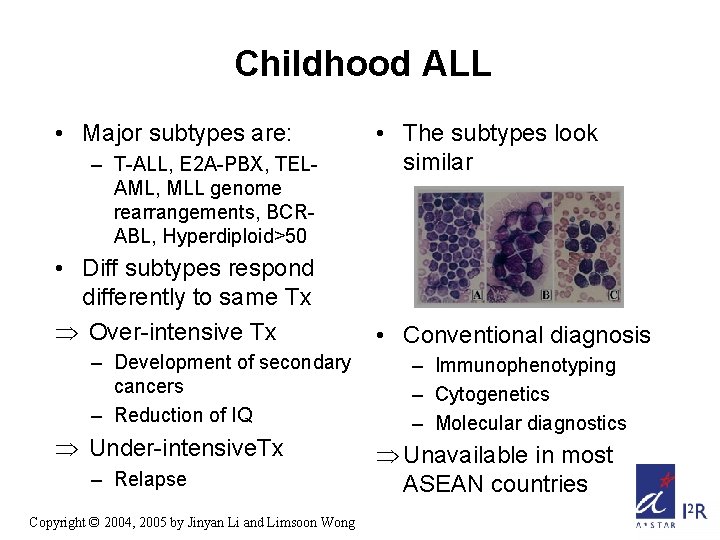 Childhood ALL • Major subtypes are: – T-ALL, E 2 A-PBX, TELAML, MLL genome