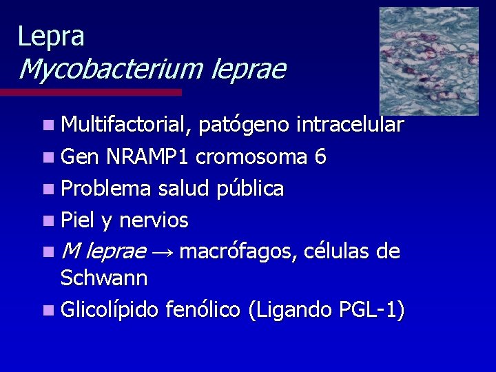 Lepra Mycobacterium leprae n Multifactorial, patógeno intracelular n Gen NRAMP 1 cromosoma 6 n