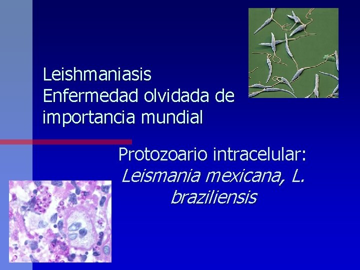 Leishmaniasis Enfermedad olvidada de importancia mundial Protozoario intracelular: Leismania mexicana, L. braziliensis 