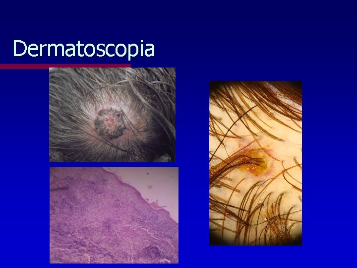 Dermatoscopia 