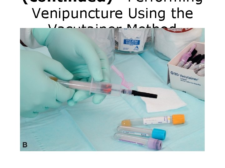(continued) Performing Venipuncture Using the Vacutainer Method FIGURE B Venipuncture procedure. 