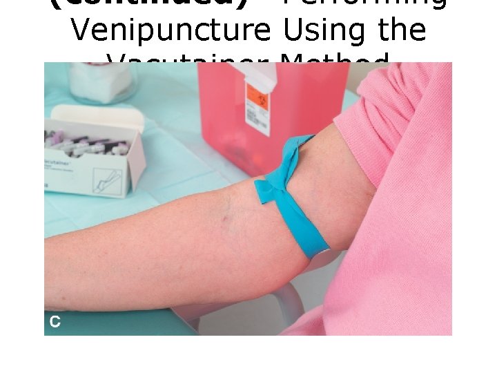 (continued) Performing Venipuncture Using the Vacutainer Method FIGURE C Venipuncture procedure. 