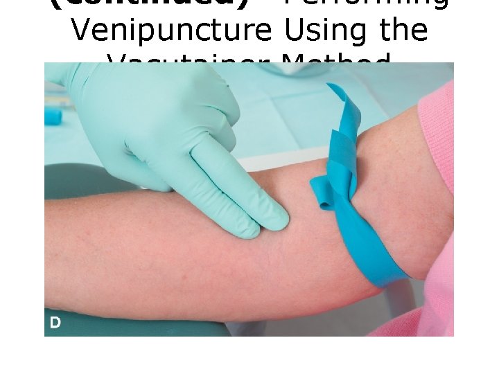 (continued) Performing Venipuncture Using the Vacutainer Method FIGURE D Venipuncture procedure. 