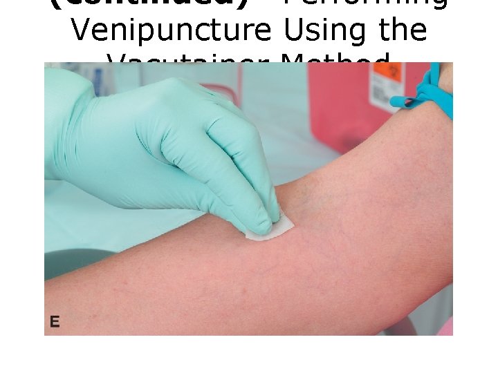 (continued) Performing Venipuncture Using the Vacutainer Method FIGURE E Venipuncture procedure. 
