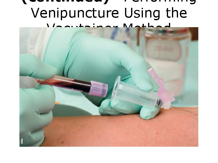 (continued) Performing Venipuncture Using the Vacutainer Method FIGURE I Venipuncture procedure. 
