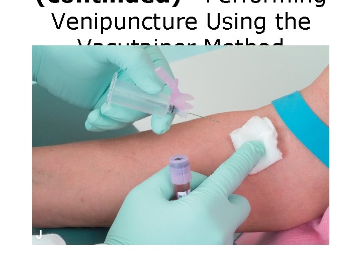 (continued) Performing Venipuncture Using the Vacutainer Method FIGURE J Venipuncture procedure. 