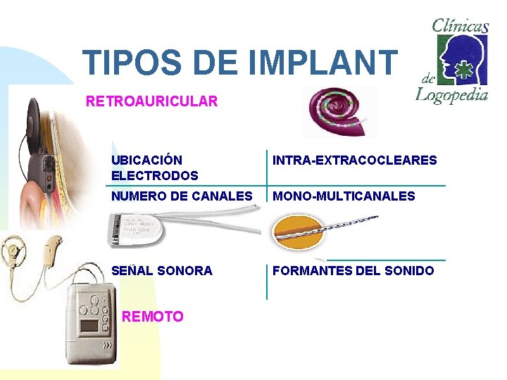 TIPOS DE IMPLANTES RETROAURICULAR UBICACIÓN ELECTRODOS INTRA-EXTRACOCLEARES NUMERO DE CANALES MONO-MULTICANALES SEÑAL SONORA FORMANTES