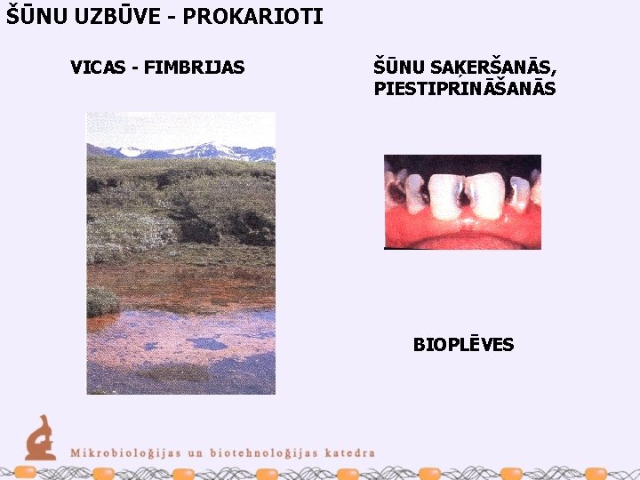 ŠŪNU UZBŪVE - PROKARIOTI VICAS - FIMBRIJAS ŠŪNU SAĶERŠANĀS, PIESTIPRINĀŠANĀS BIOPLĒVES 