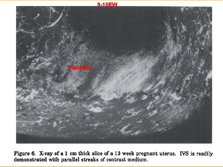 9 -10 EW Plazenta 