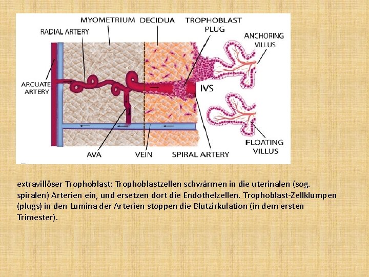 extravillöser Trophoblast: Trophoblastzellen schwärmen in die uterinalen (sog. spiralen) Arterien ein, und ersetzen dort