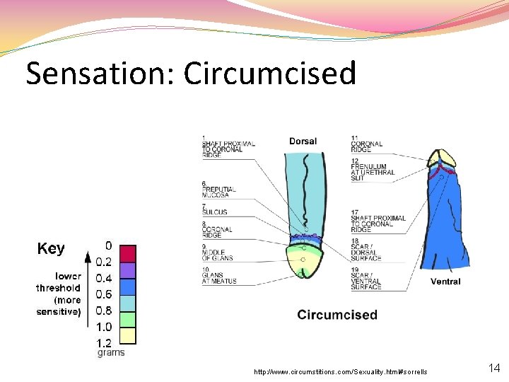 Sensation: Circumcised http: //www. circumstitions. com/Sexuality. html#sorrells 14 