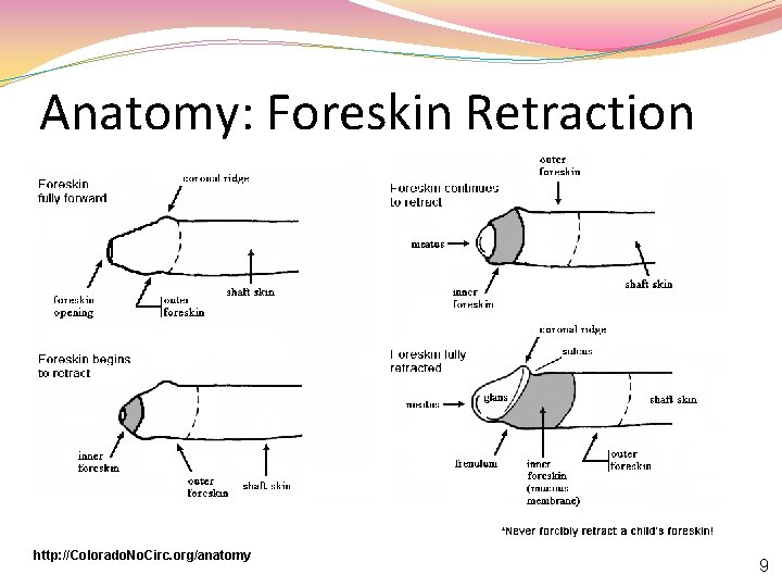 Anatomy: Foreskin Retraction http: //Colorado. No. Circ. org/anatomy 9 