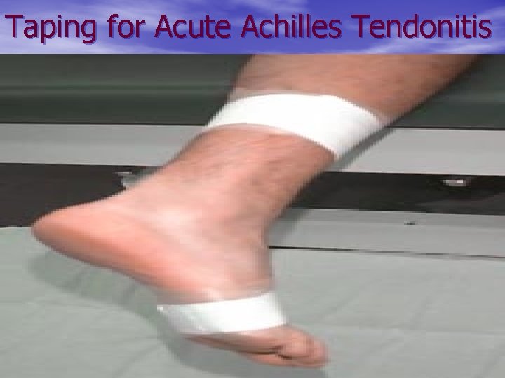 Taping for Acute Achilles Tendonitis 