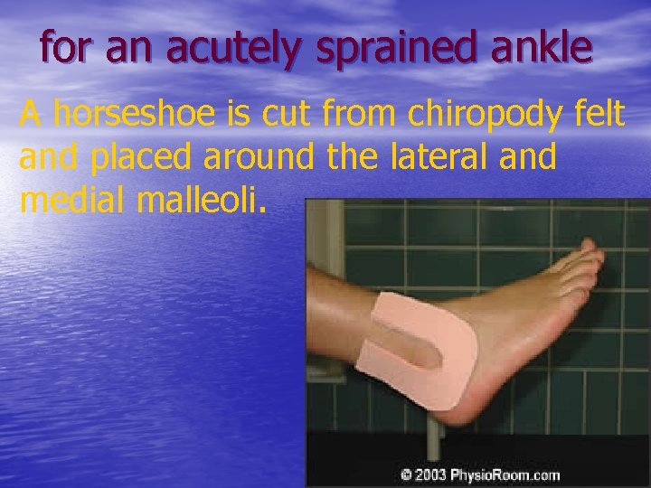 for an acutely sprained ankle A horseshoe is cut from chiropody felt and placed