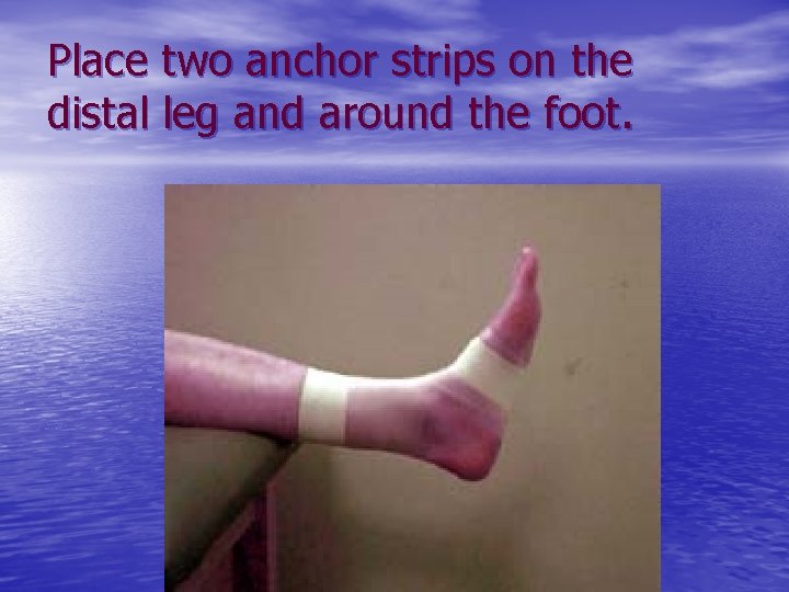 Place two anchor strips on the distal leg and around the foot. 
