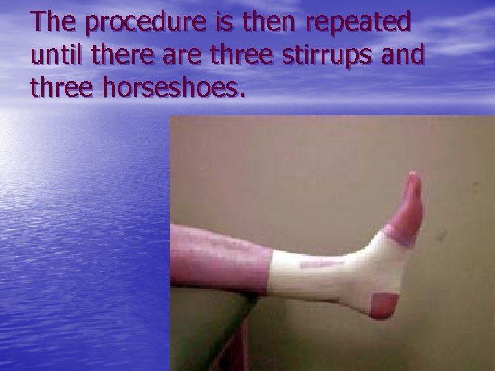 The procedure is then repeated until there are three stirrups and three horseshoes. 