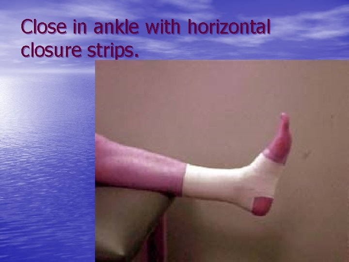 Close in ankle with horizontal closure strips. 
