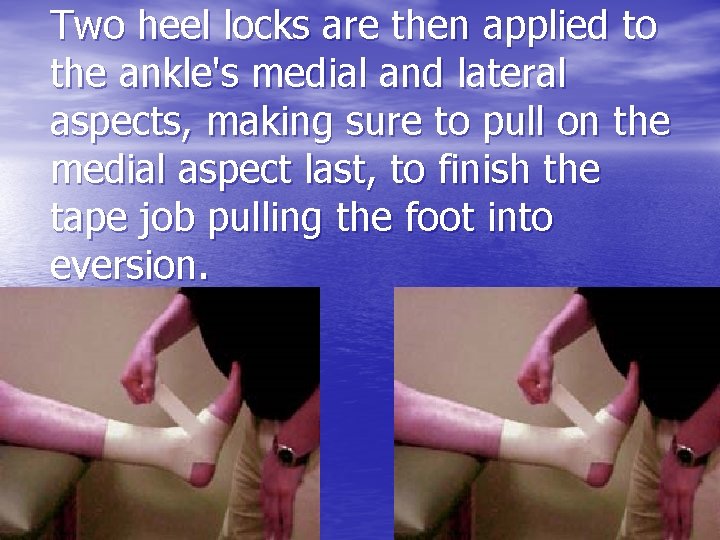 Two heel locks are then applied to the ankle's medial and lateral aspects, making